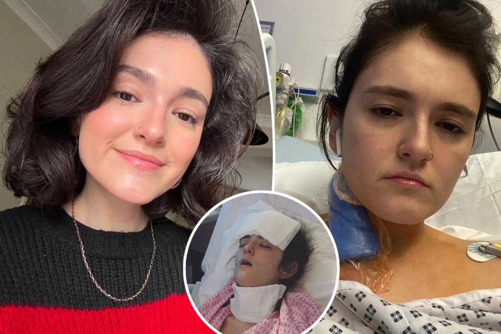 Woman with 'Nutcracker Syndrome' in constant pain, ruled out by doctors