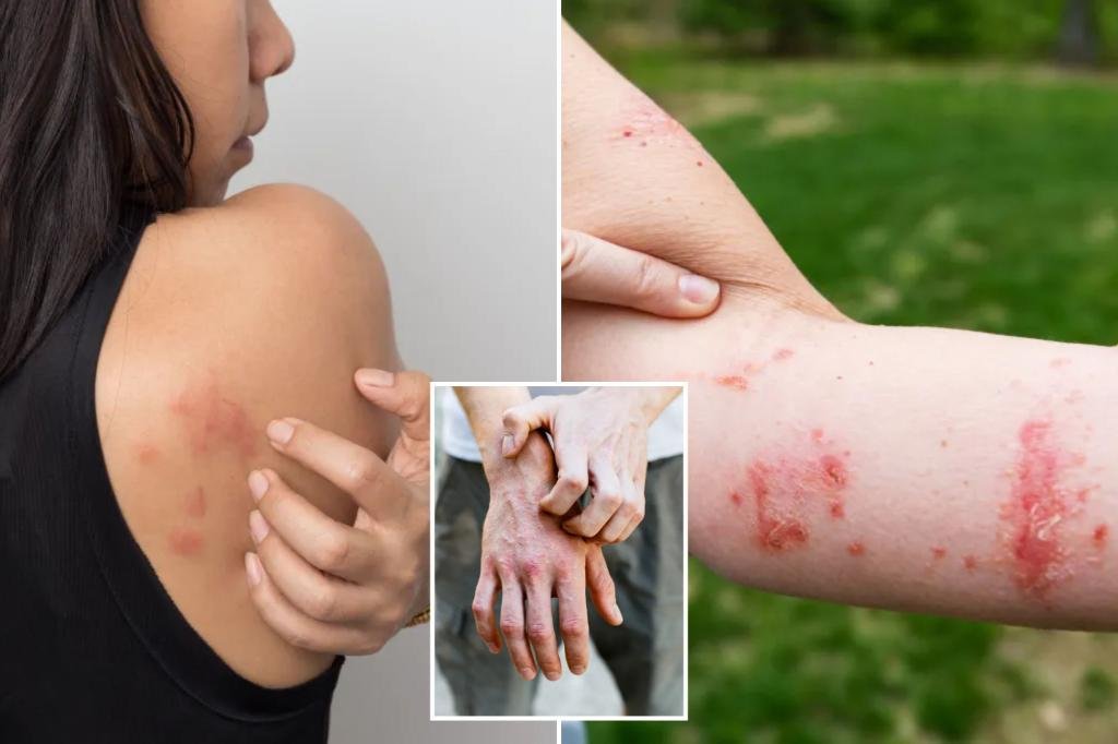 The new study reveals itching a scratching rash has several benefits