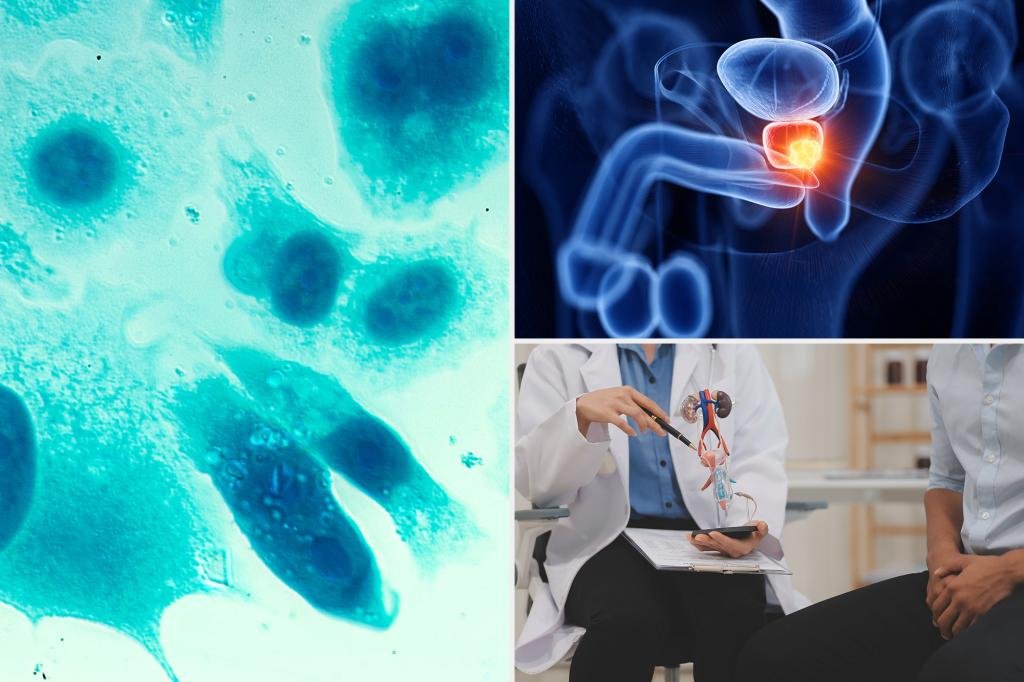 The risk of prostate cancer increases by 45% among men who share a disturbing behavior
