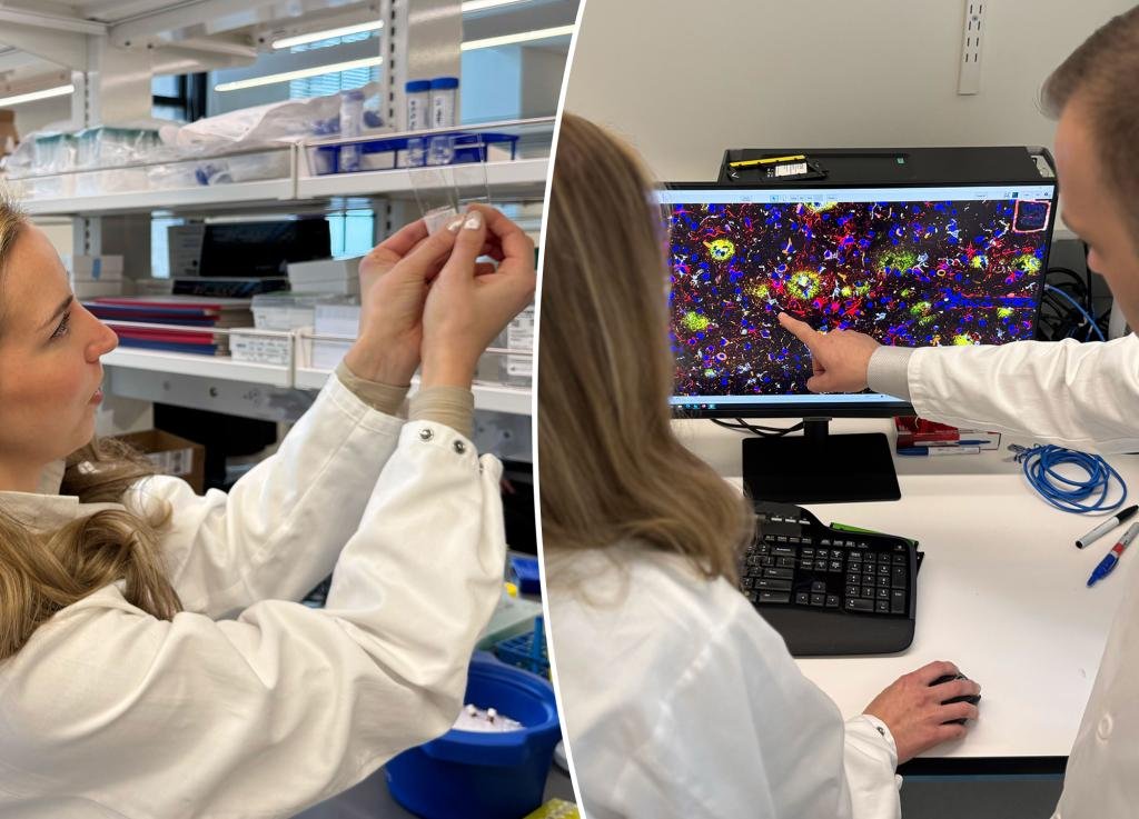 The main discovery of the brain can revolutionize Alzheimer's treatment
