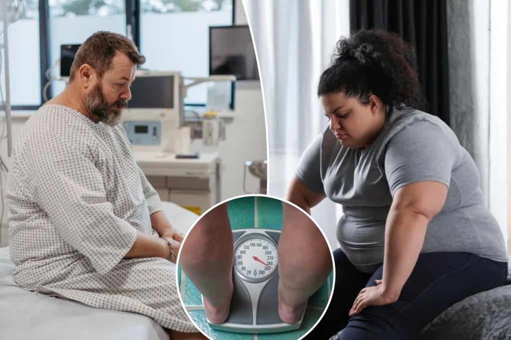 More than half of adults are expected to be overweight or obese by 2050